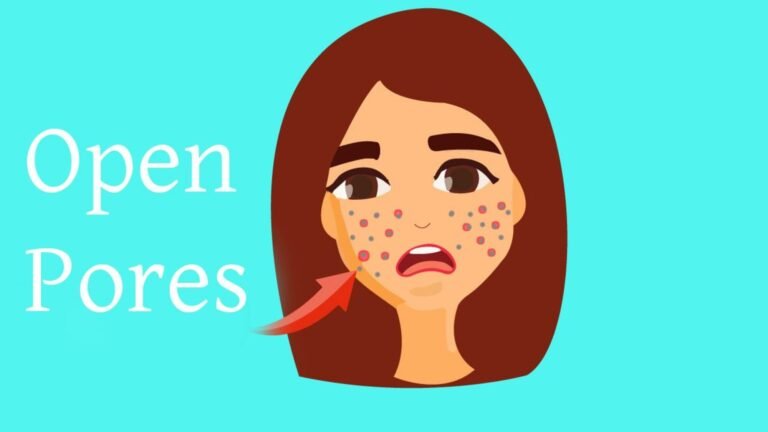 open pores
