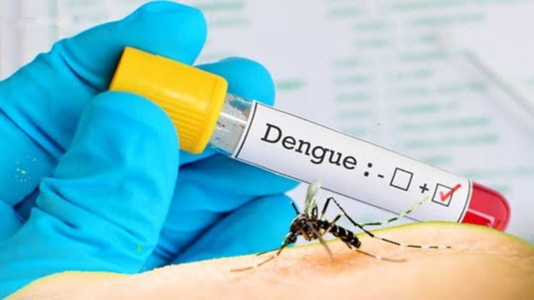 Dengue fever