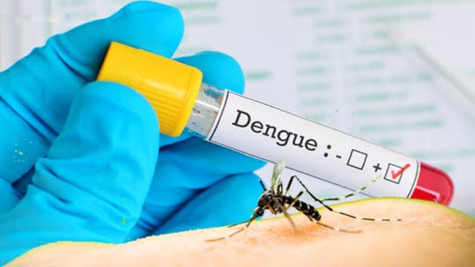 Dengue fever