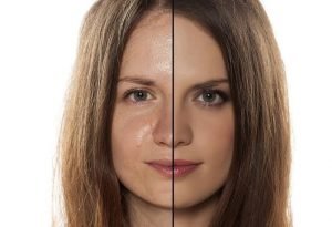 Prevention for oily skin