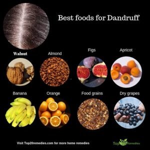 Diet for dandruff 