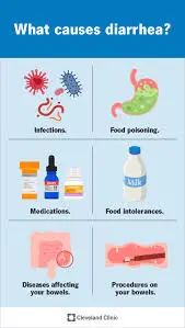 Factor contributing Diarrhea 